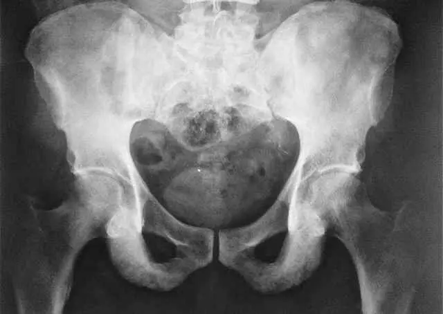 Лікування ревматичних захворювань в Києві, лівий берег