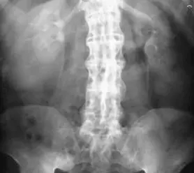 Лікування ревматичних захворювань в Києві, лівий берег