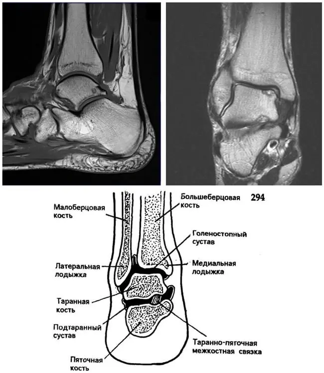 МРТ суглобів в Києві на Лівому березі