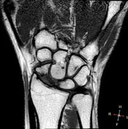 МРТ суглобів в Києві на Лівому березі