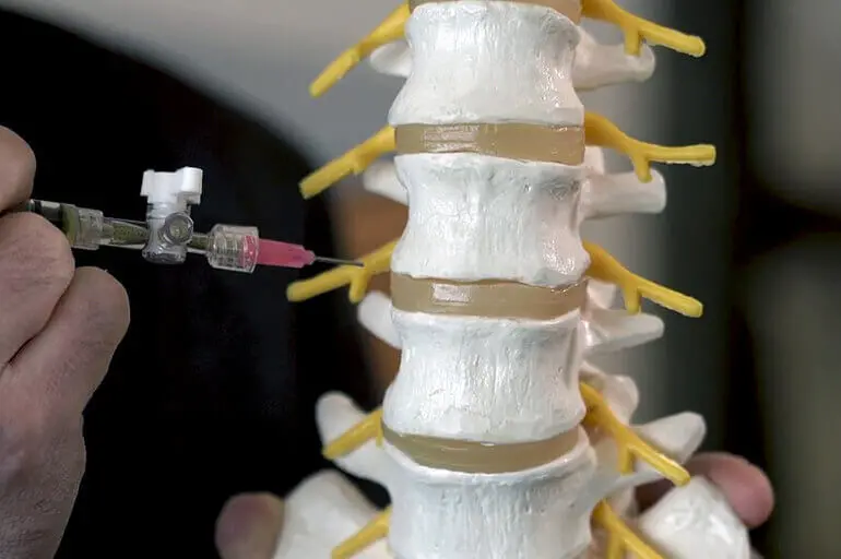 Грижа диска L5-S1