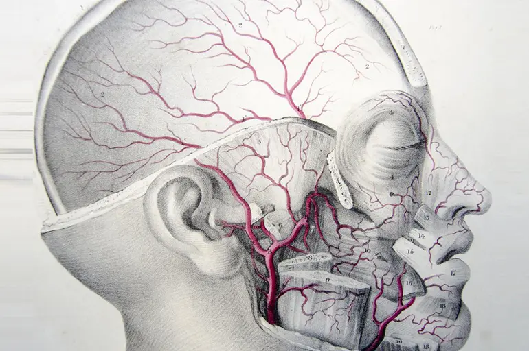 сосуды мозга