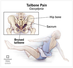 Почему болит копчик? Причины боли в копчике. Что делать при болях в копчике у мужчин и женщин?