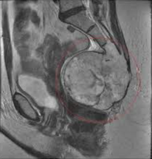 Почему болит копчик? Причины боли в копчике. Что делать при болях в копчике у мужчин и женщин?