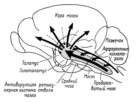Электроэнцефалография (ЭЭГ) в Киеве