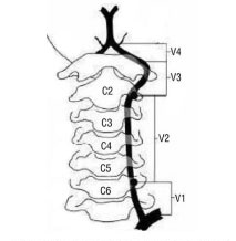 Головокружение и его симптомы? Что делать?