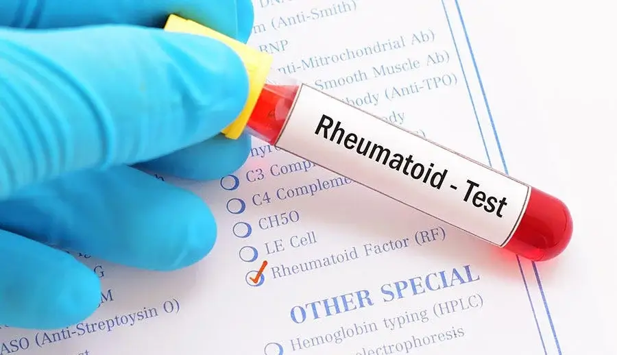 що таке ревмопроби коли робити