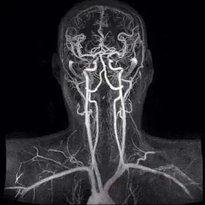 чому темніє в очах