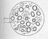 Схема смешанного межреберного нерва