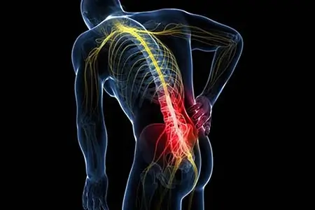 простріл в попереку